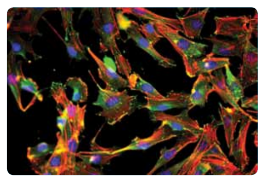 Two major players in mechano-sensing are actin stress fibres and focal adhesion points. Cells apply contractile force on their surroundings via focal adhesion points (Green dots, vincluin) situated at the end of actin stress fibres (Red lines, actin-phalloidin). Nuclei are shown in blue (DAPI). 