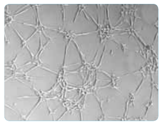 Mesenchymal Stem Cells formed network pattern. Although the mechanism of such pattern formation is not completely understood, it is assumed that force interaction play an important role in aligning neighbouring cells. Such pattern formation may give us important clues in understanding morphogenesis