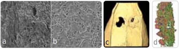 Nano-biocomposite Bone Grafts for reconstructive Surgery