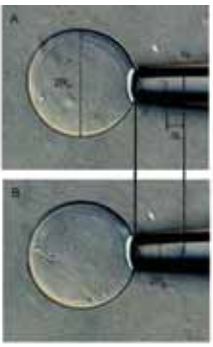 Micropipette aspiration of phospholipid vesicles to determine membrane properties