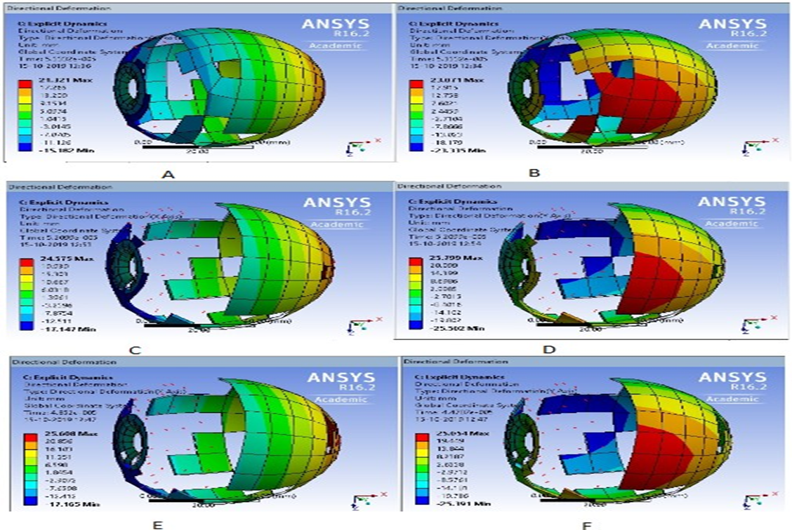 Balloon bursting of thickness 7 mm, 8 mm, and 8.5 mm at nearby critical pressure. (A and B) deformation in X and Y direction of thickness 7 mm. (C and D) deformation in both directions of thickness 8 mm. (E and F) deformation in both directions of thickness 8.5 mm In general, the elastomers are used as material for balloons.